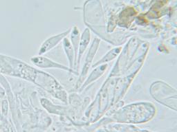 Orbilia pseudoaristata