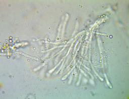 Pyrenopeziza petiolaris