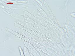 Arachnopeziza leonina