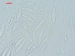 Chaetosphaeria ovoidea