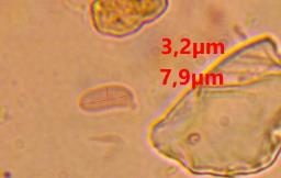Resinicium bicolor