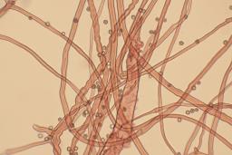 Tulostoma squamosum