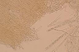 Lanzia luteovirescens