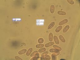 Ceratiomyxa fruticulosa