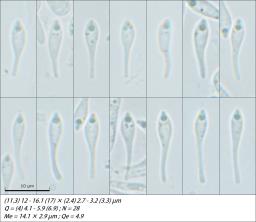 Orbilia pseudoaristata