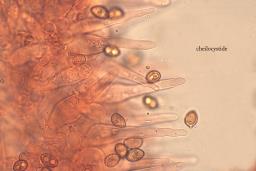 Galerina vittiformis