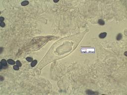 Typhrasa gossypina