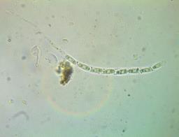 Phomatospora berkeleyi