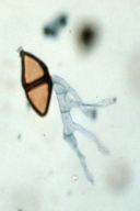 Gymnosporangium sabinae