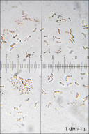 Tectella patellaris