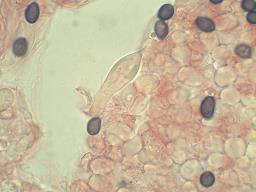 Stropharia rugosoannulata