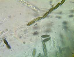 Lopadostoma dryophilum