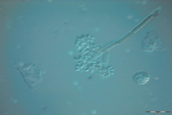 Botryotinia fuckeliana