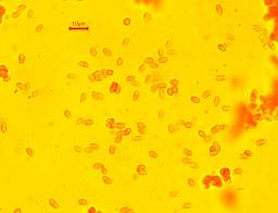 Rhodocollybia asema
