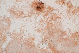 Resupinatus striatulus