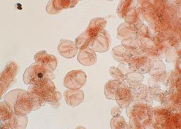 Narcissea cordispora