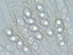 Octospora phagospora