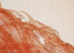 Pseudosperma obsoletum