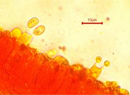 Tubaria furfuracea