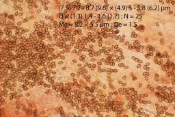 Cortinarius pratensis