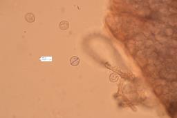 Arcyria denudata