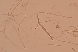 Hohenbuehelia petaloides