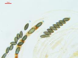 Hypomontagnella submonticulosa