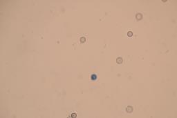 Apioperdon pyriforme