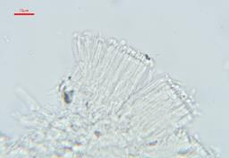 Polycephalomyces ditmarii