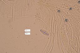 Lanzia luteovirescens