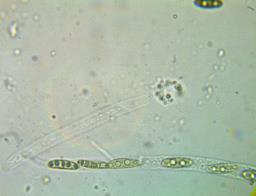 Lopadostoma dryophilum