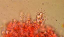 Sistotrema brinkmannii