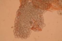 Arcyria denudata