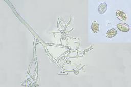 Peronospora alsinearum