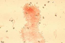 Hebeloma laterinum