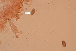Conocybe aurea