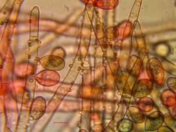 Botryobasidium conspersum