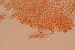 Atractosporocybe inornata