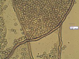 Lycoperdon lividum