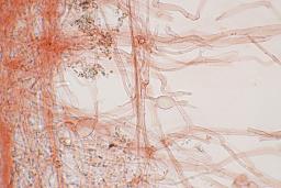 Clitocybe phaeophthalma