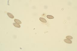 Suillellus luridus