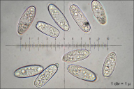 Sarcoscypha austriaca