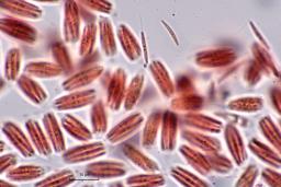 Ophiognomonia setacea