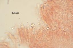 Infundibulicybe trulliformis