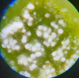 Pseudomicrostroma juglandis