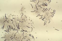 Hypoxylon fuscum