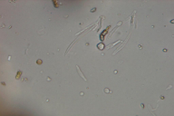 Gremmeniella abietina