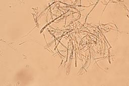 Calycina citrina