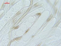 Pseudoplectania nigrella