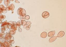 Narcissea cordispora